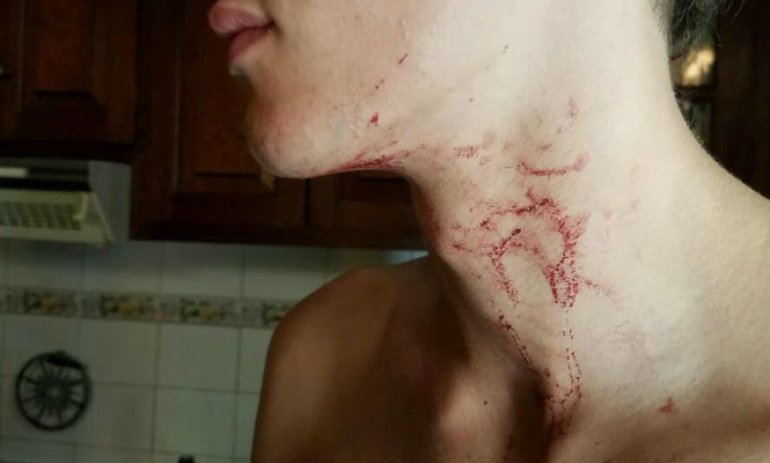 Patota atacó a golpes a un estudiante en pleno centro de Pilar